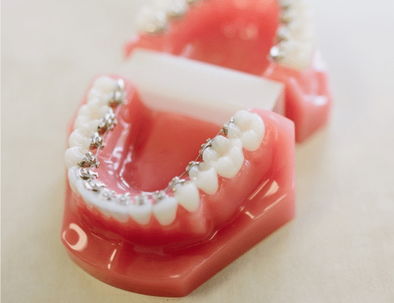 lingual grand rapids orthodontics